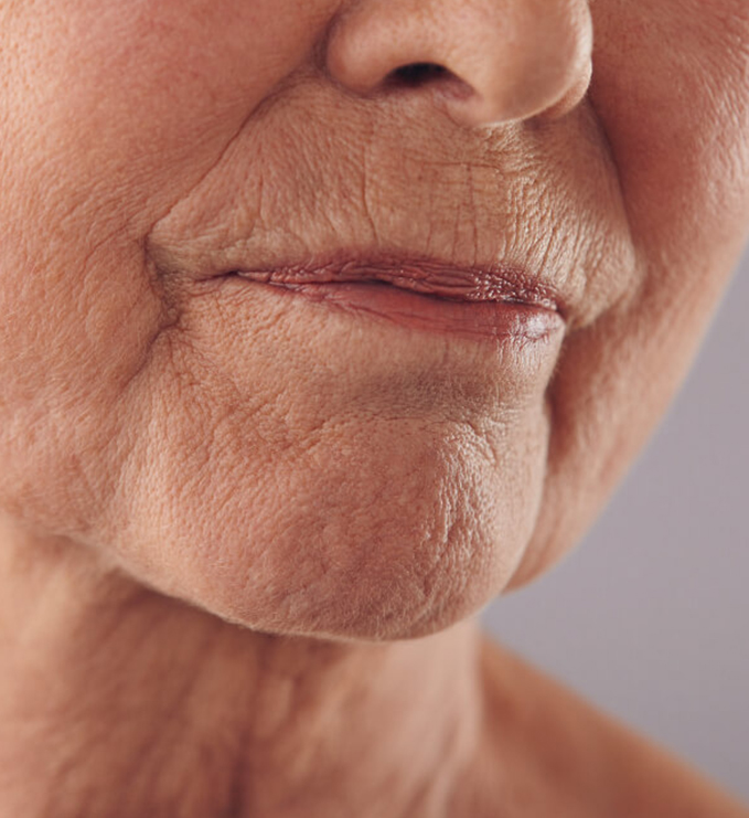 The solution to your crepey skin?