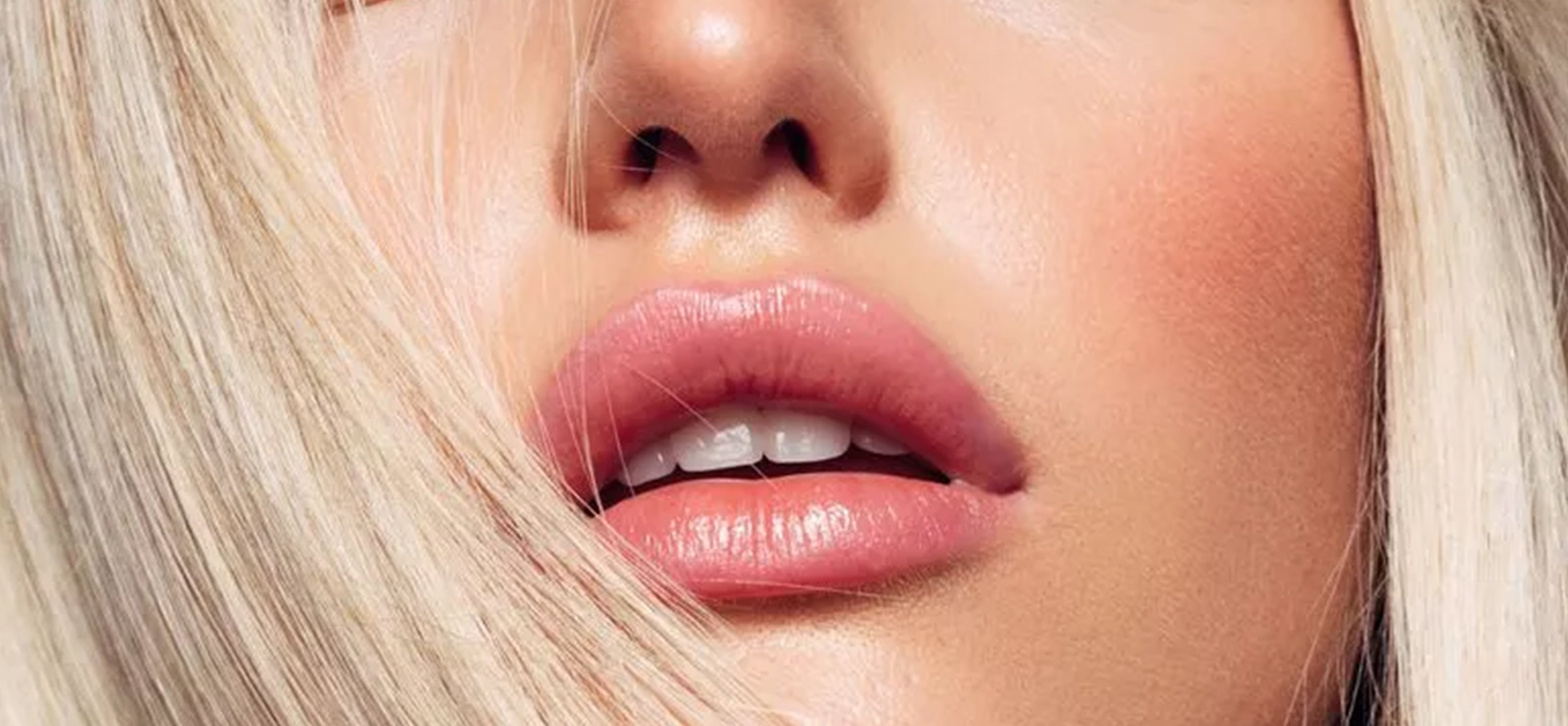 Lip Fillers at SOMA Body Clinic, Trowbridge