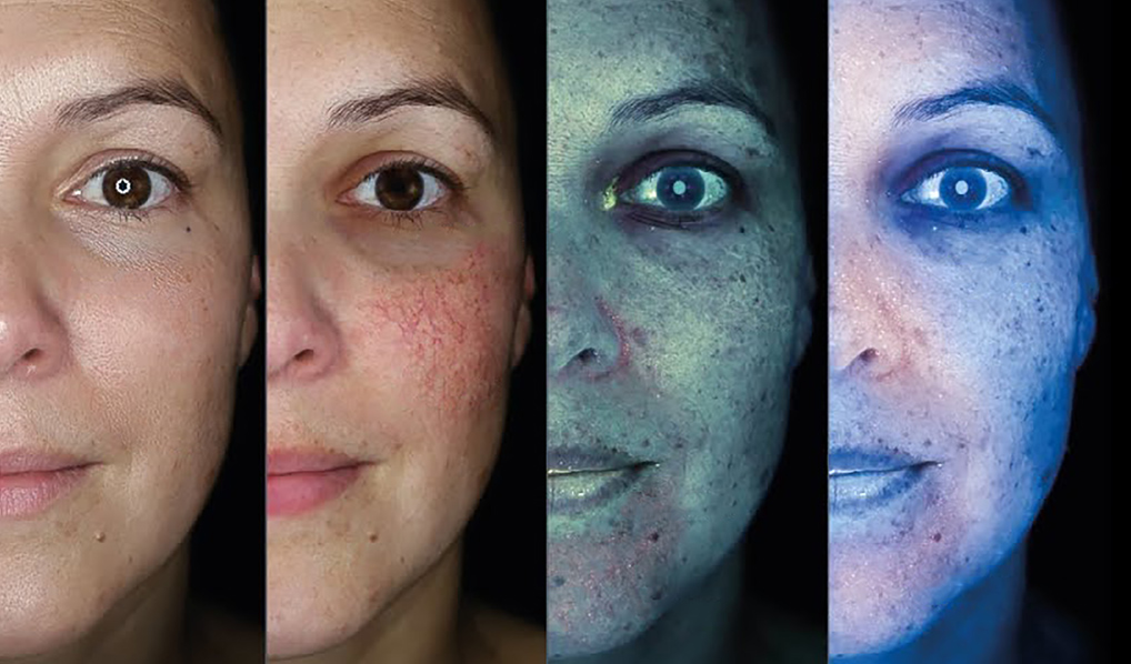 deep face anaylsis deep face anaylsis