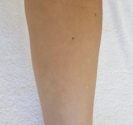 small tattoo - after