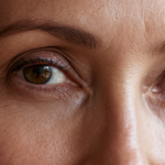 botox in trowbridge